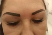 Rabat na: pedicure hybrydowy, zabiegi na twarz- mezoterapia mikroigłowa, infuzja tlenowa, opalanie